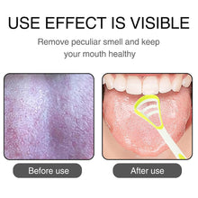Oral Tongue Cleaner Brush Scraper Health Personal Care Dental Care Tongue Cleaner (1 Pc / Multicolor) - luckystorebuy.in